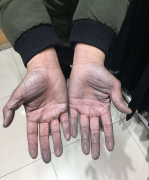 牛仔裤脱色男子报警：人家说我挖煤的